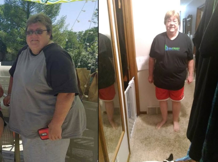 Weight Loss Success: How Pam Lost 120 Pounds & Kept It Off